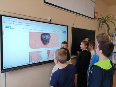 Uczniowie szkoły w trakcie realizacji programu dotyczącego czerniaka